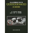 がん化学療法における有害事象管理の実際