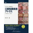 チェアサイド・介護で役立つ口腔粘膜疾患アトラス　どこで見わけて、どう対応？