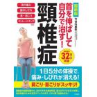 首を伸ばして自分で治す！頸椎症