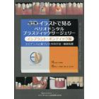 ３Ｄイラストで見るペリオドンタルプラスティックサージェリー　インプラント・ポンティック編