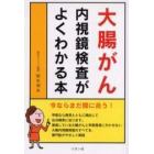 大腸がん内視鏡検査がよくわかる本　今ならまだ間に合う！