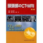 頭頸部のＣＴ・ＭＲＩ