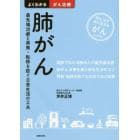 肺がん　最先端治療と再発・転移を防ぐ日常生活の工夫　知る治す共に生きるがん