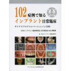 １０２症例で知るインプラント日常臨床　サイナスフロアエレベーションとＧＢＲ　日本インプラント臨床研究会全員発表会６ｔｈ抄録集