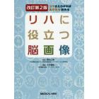 リハに役立つ脳画像　コツさえわかればあなたも読める