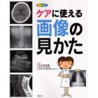 ケアに使える画像の見かた　Ｘ線写真・ＣＴ画像・エコー像・ＭＲＩ