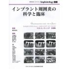 インプラント周囲炎の科学と臨床