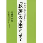 「乾癬」の原因とは？　皮膚の悩みに光を！