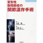 変形性股関節症の関節温存手術