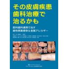 その皮膚疾患歯科治療で治るかも　医科歯科連携で治す歯性病巣感染＆金属アレルギー