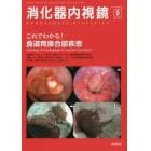 消化器内視鏡　Ｖｏｌ．２９Ｎｏ．９（２０１７Ｓｅｐｔｅｍｂｅｒ）