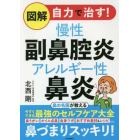 図解自力で治す！慢性副鼻腔炎アレルギー性鼻炎