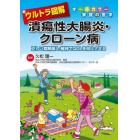 ウルトラ図解潰瘍性大腸炎・クローン病　正しい寛解導入・維持でＱＯＬを向上させる