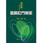 内科医にもわかる直腸肛門病変