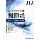 若年性特発性関節炎カナキヌマブ治療の理論と実際