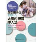 医師と内視鏡技師のコラボによる腹部用手圧迫を用いた大腸内視鏡挿入法　患者にやさしい内視鏡検査