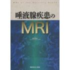 唾液腺疾患のＭＲＩ