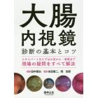 大腸内視鏡診断の基本とコツ　エキスパートならではの見かた・着眼点で現場の疑問をすべて解決