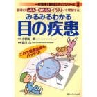 みるみるわかる目の疾患　眼球の《しくみとはたらき》イラストで理解する！　これで患者説明もバッチリ！