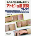 あらゆる診療科で役立つアトピー性皮膚炎アトラス　典型疹から間違えやすい皮疹まで２４３点の症例写真で「これってアトピー？」に答える！