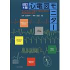 心電図モニター　ベッドサイドで役立つ波形の見方と緊急時対処の基本