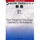 新癌の外科－手術手技シリーズ　９