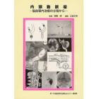 内頸動脈瘤　脳血管内治療の立場から　第１５回脳血管内治療仙台セミナー講演集