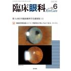 臨床眼科　２０２３年６月号